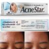AcneStar Gel