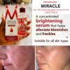 Miracle Anti-Melasma Serum and Brightening